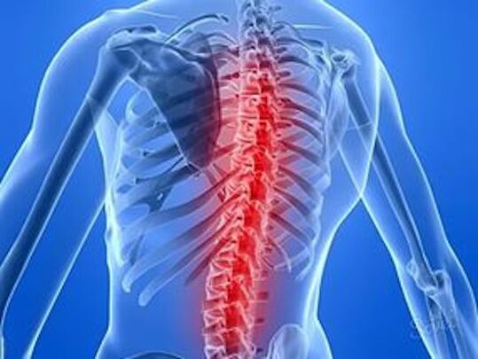 Back pain caused by spinal disease