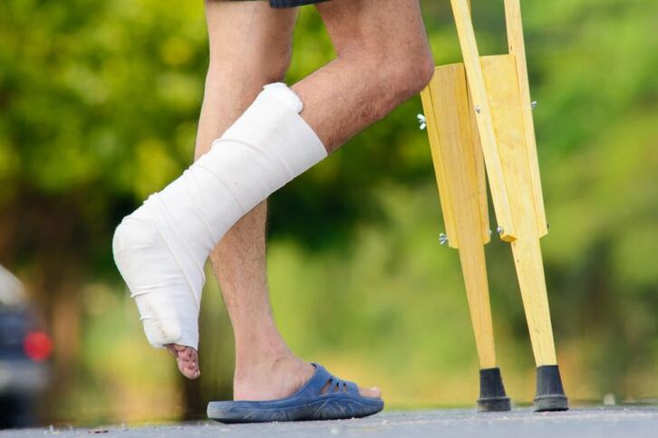 Ankle Injury is a Cause of Arthropathy